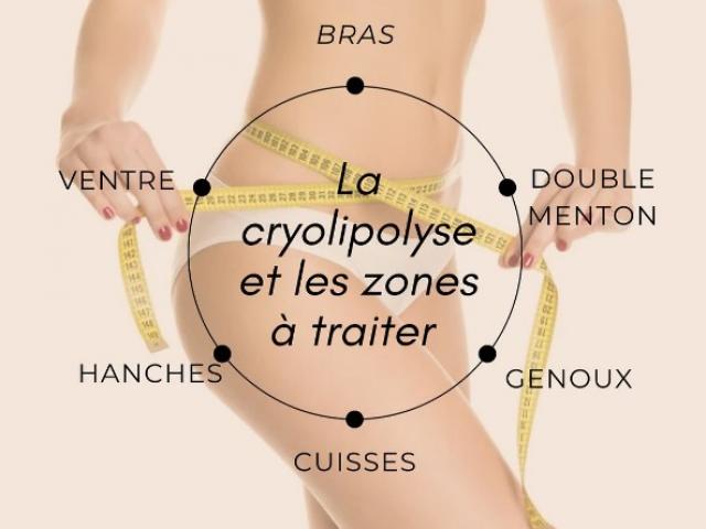 Comment fonctionne la cryolipolyse ?  la minceur par le froid 